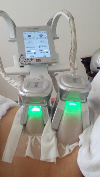 Locação de Máquina de Criolipólise de Última Geração !!!!